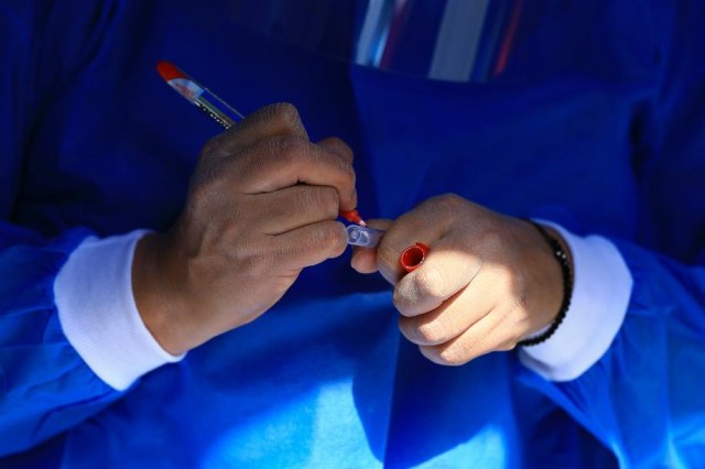 Koliko dugo možete da imate pozitivan test na koronu i da li to znači da ste još uvek zarazni?